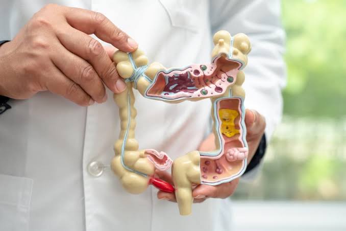 Irritable Bowel Syndrome (IBS) Management