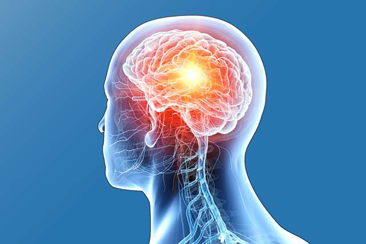 Brain Tumor Treatment