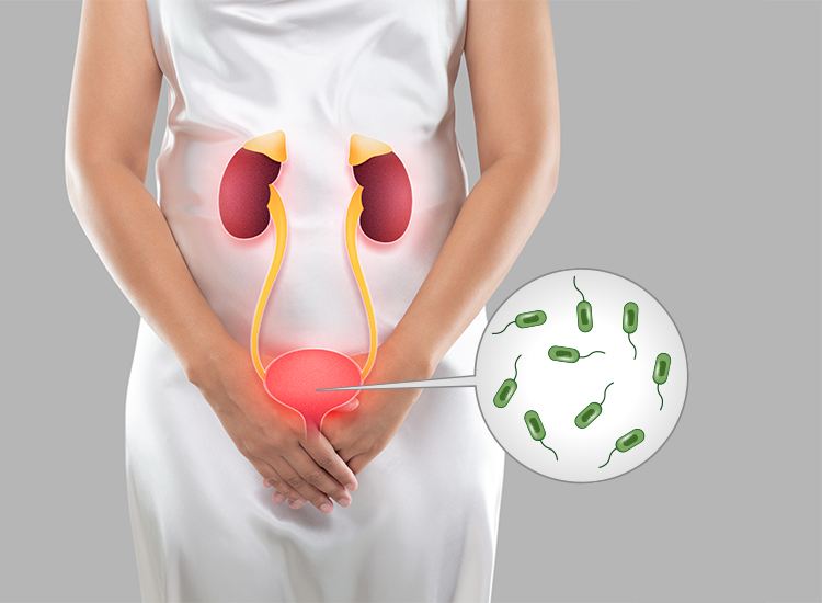 Urinary Tract Infection (UTI) Treatment
